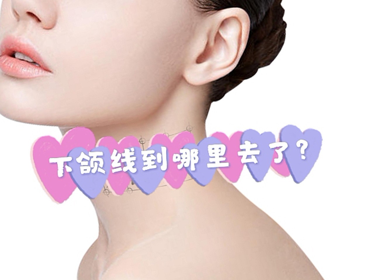 下颌线到哪里去了?