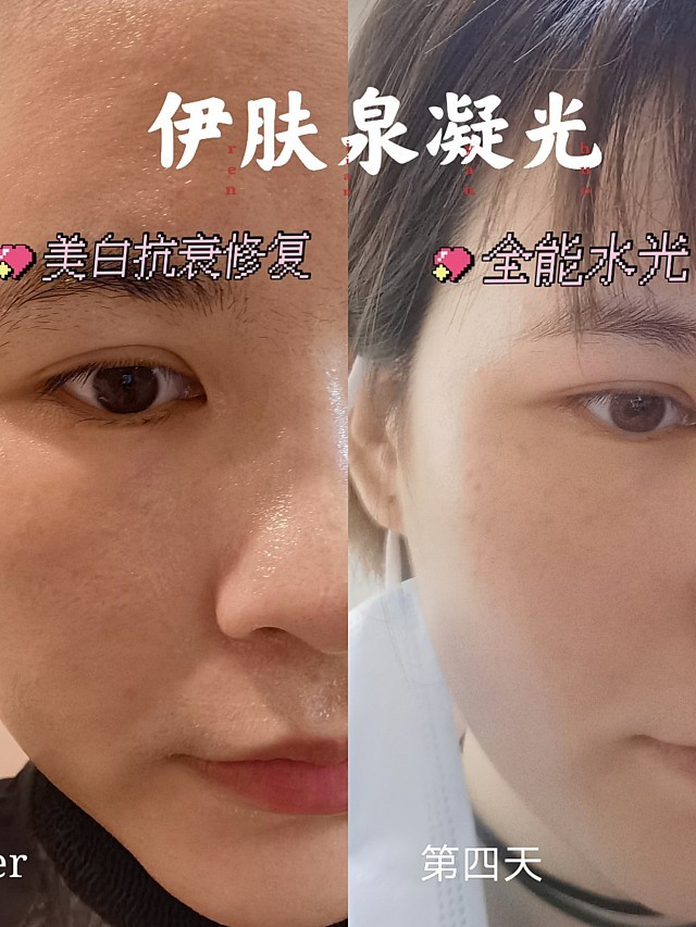 两次伊肤泉凝光ert有什么效果