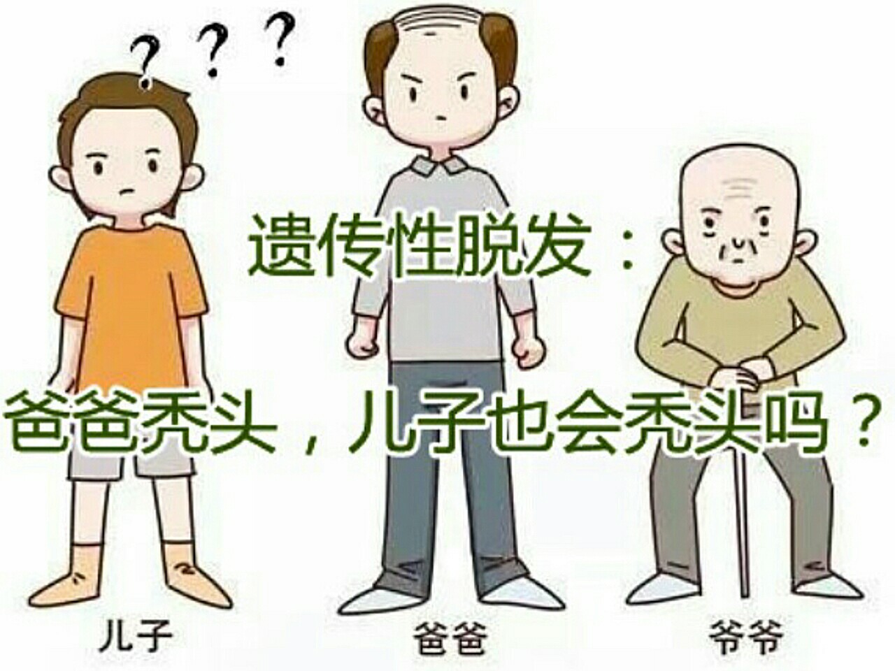 遗传性脱发爸爸秃头儿子也会秃头吗