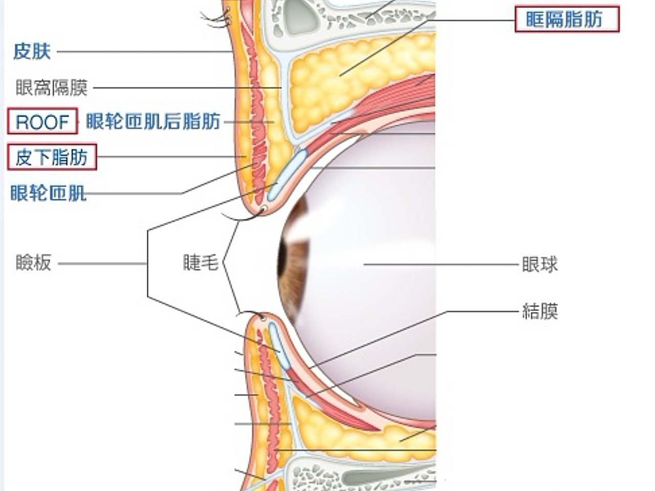 roof竟是肿眼泡的元凶之一?