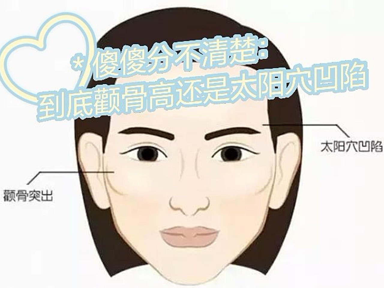 傻傻分不清楚到底颧骨高还是太阳穴凹陷