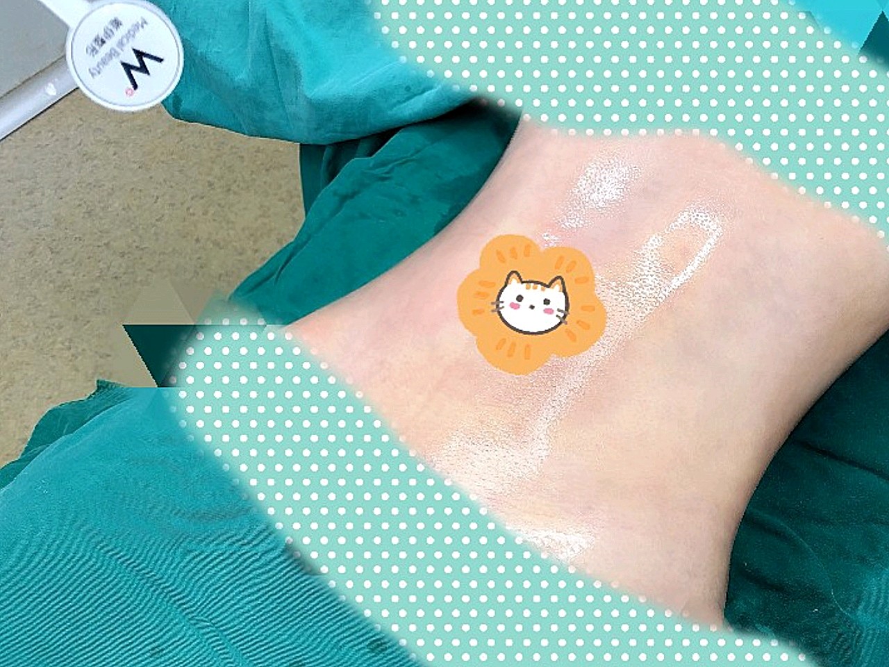 变美诉求:肚子上一大圈的赘肉真的就跟游泳圈一样成天