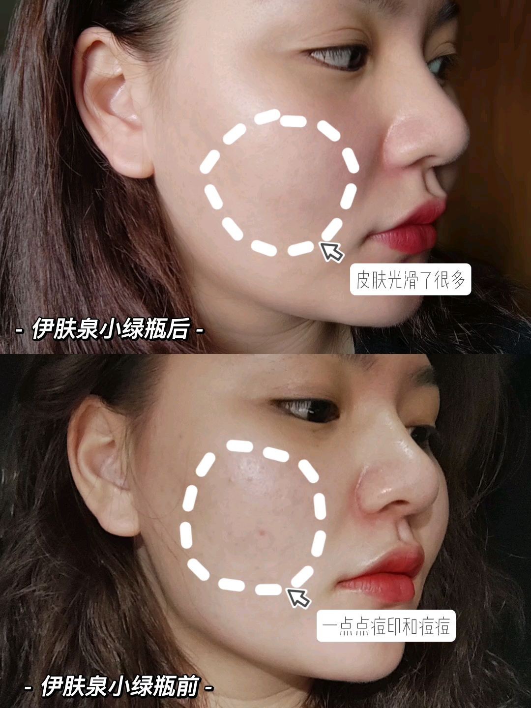 伊肤泉小绿瓶效果对比达人招募101计划