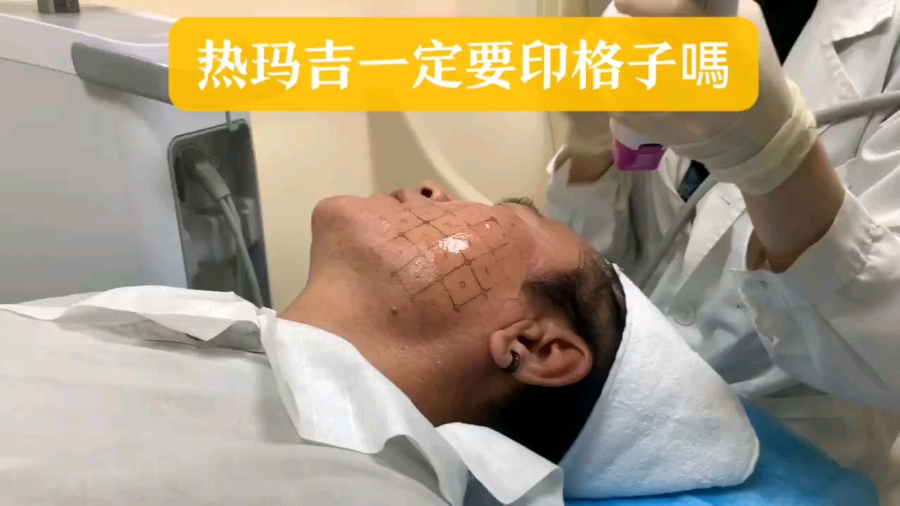 热玛吉一定要印格子吗操作才准确