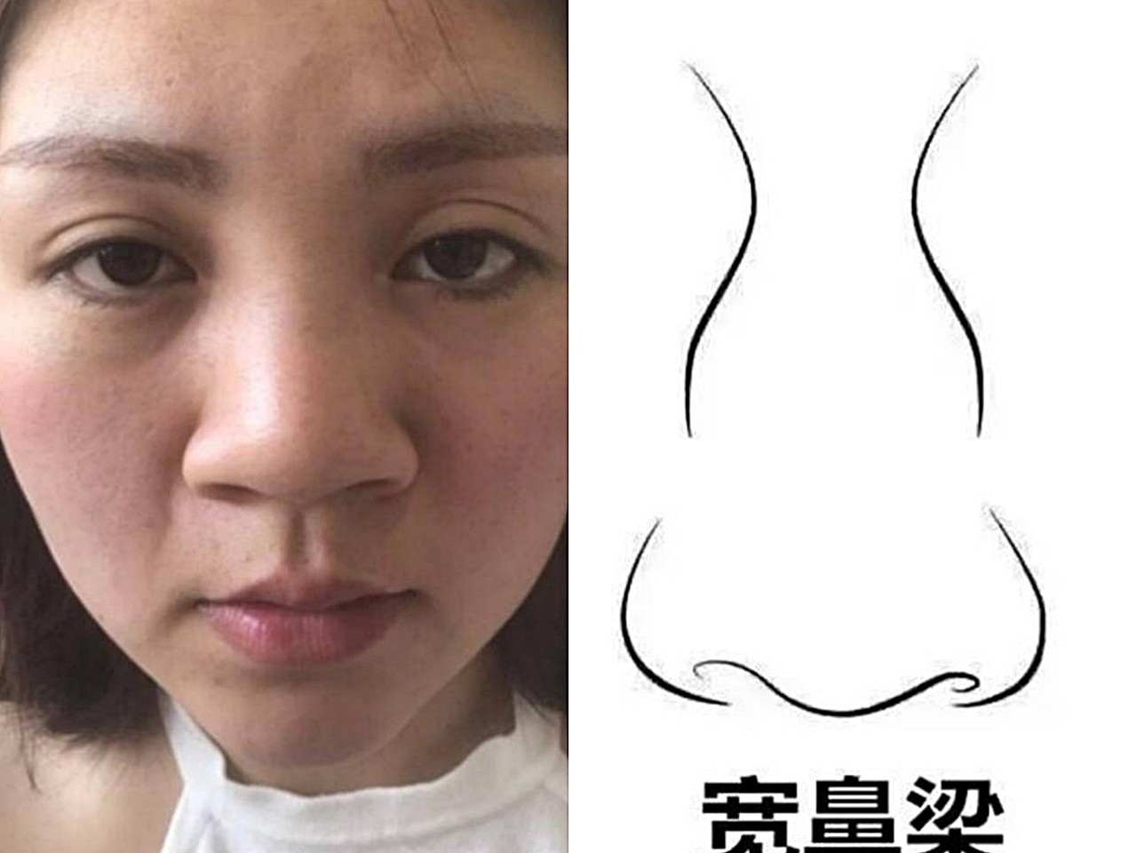 公认的5种影响颜值的鼻型,你中招了吗?