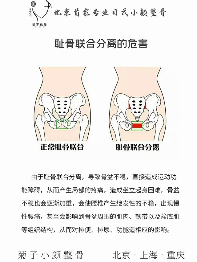 耻骨闭合的重要性