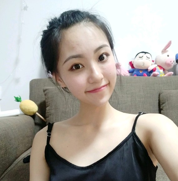 【长沙健丽-不开刀去眼袋】眼部手术后,是不是