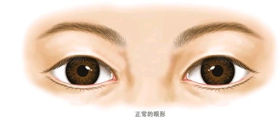 【郑州俪侬整形】韩国眼形矫正术的方法眼形矫