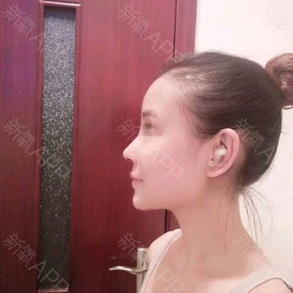 【上海李月辉-刘伟峰】1、鼻综合整形是怎么回