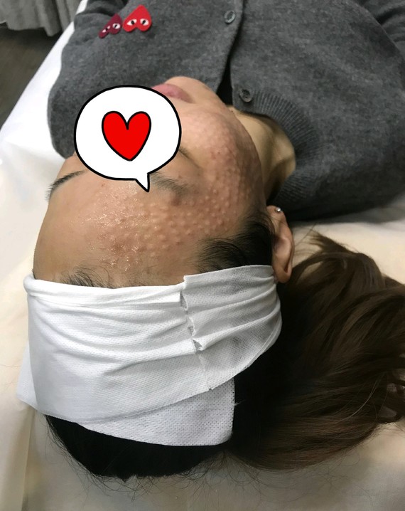 来一个强迫症看不下去的手针丝丽动能素的皮丘,丝丽动能素提亮肤色