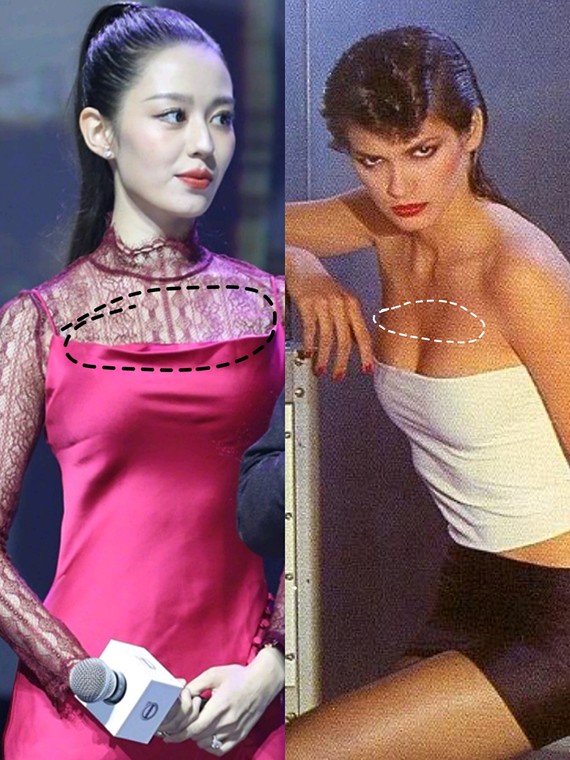 怎么隆胸会显得自然呢?_圈子-新氧美容整形