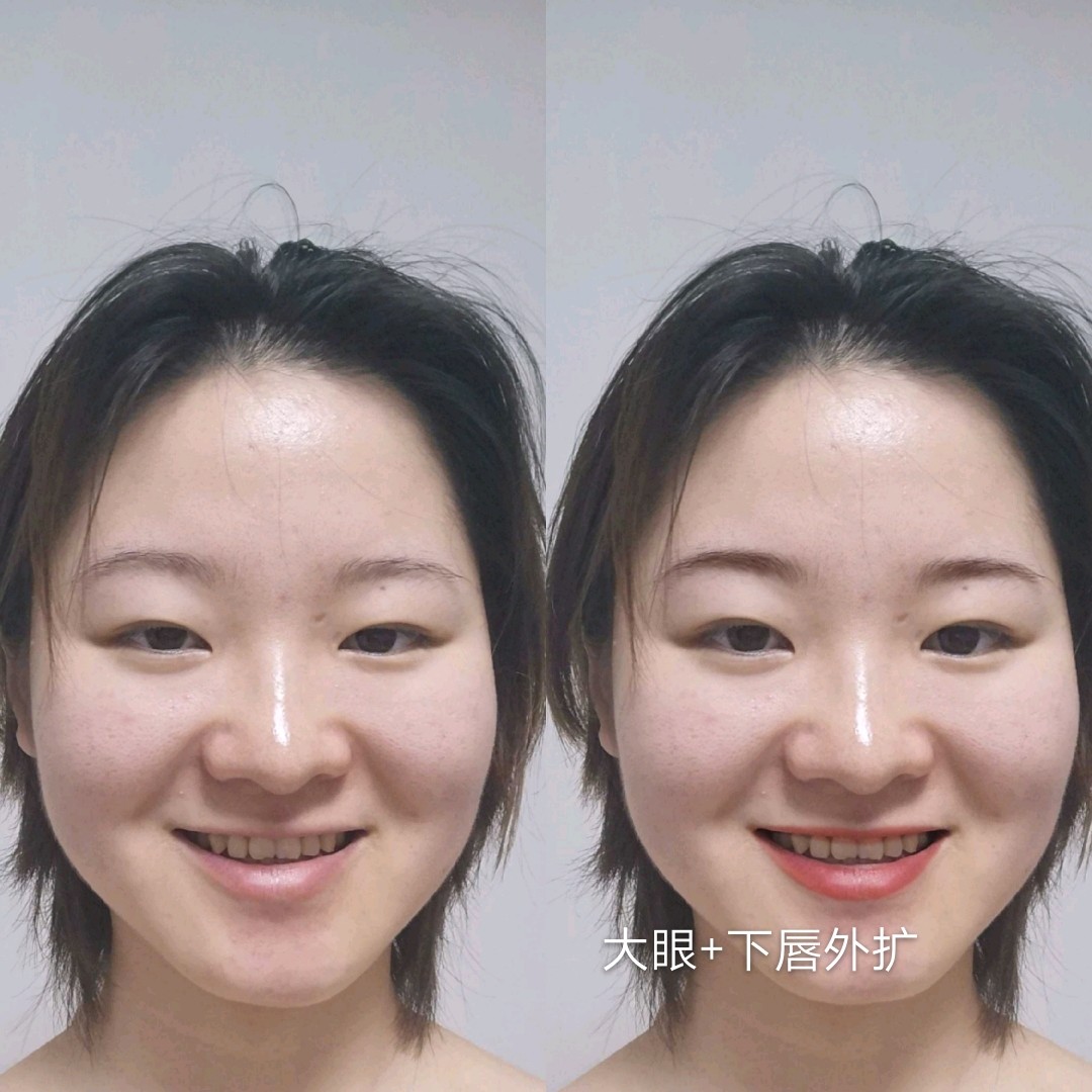 不确定自己是嘴凸还是面中凹陷脸颊上的两块真的好奇怪是颧骨太大还是
