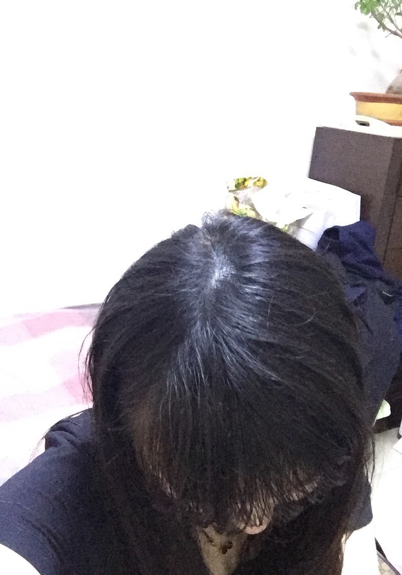 好几天没洗头,还是有点露头皮,但是也比没做之前好很多了,不知道在洗
