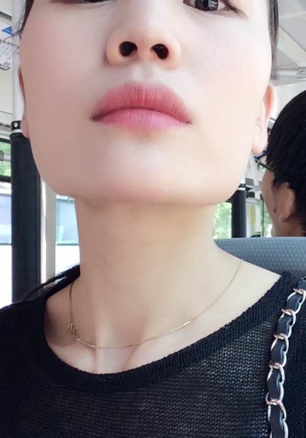 这是第二次没打之前的脸 咬肌还是有的 希望这次效果更好 期待.
