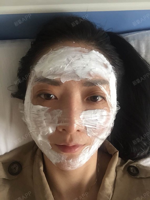 杭州水光针好不好_效果图_泡沫_271360水光针术后第天