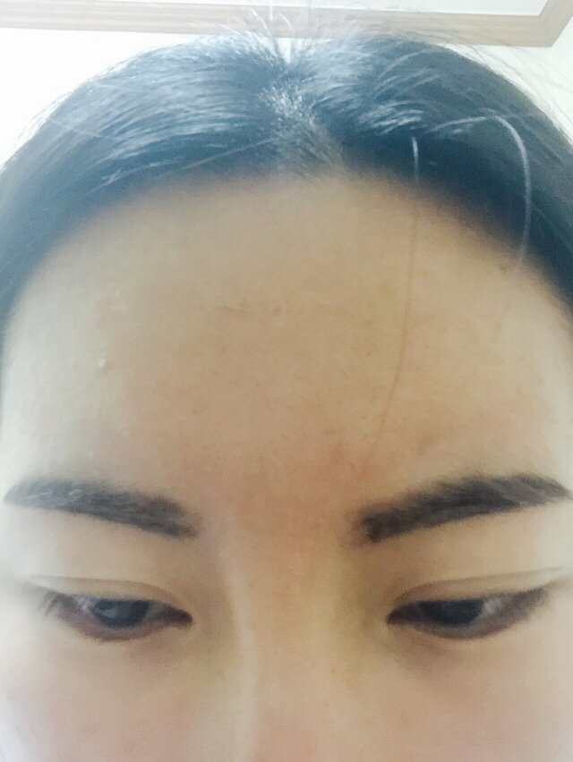 半永久纹眉,第二天,像个蜡笔小新
