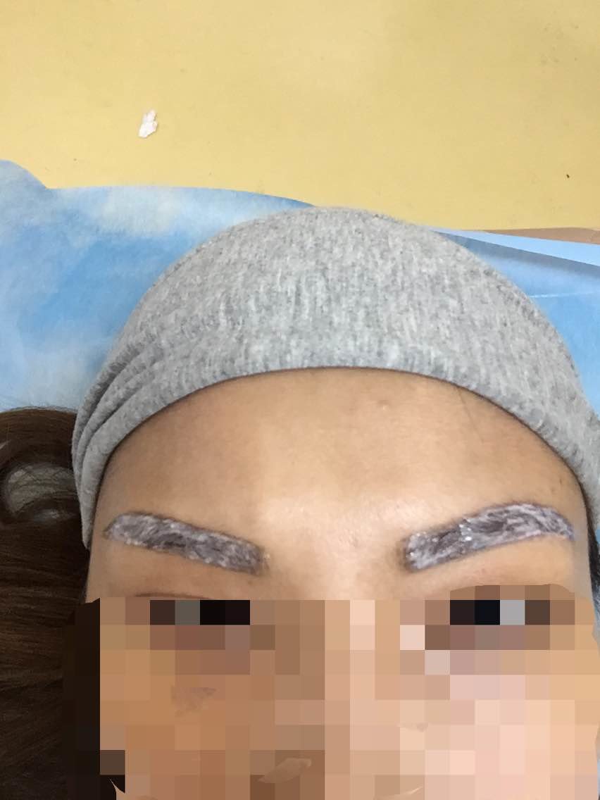 纹眉当天拍的,上了麻药后一点都不疼