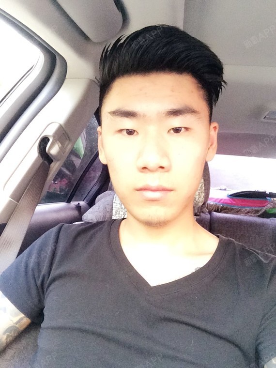 该怎么整,想把眼睛和鼻子做了,疤痕性皮肤,是不