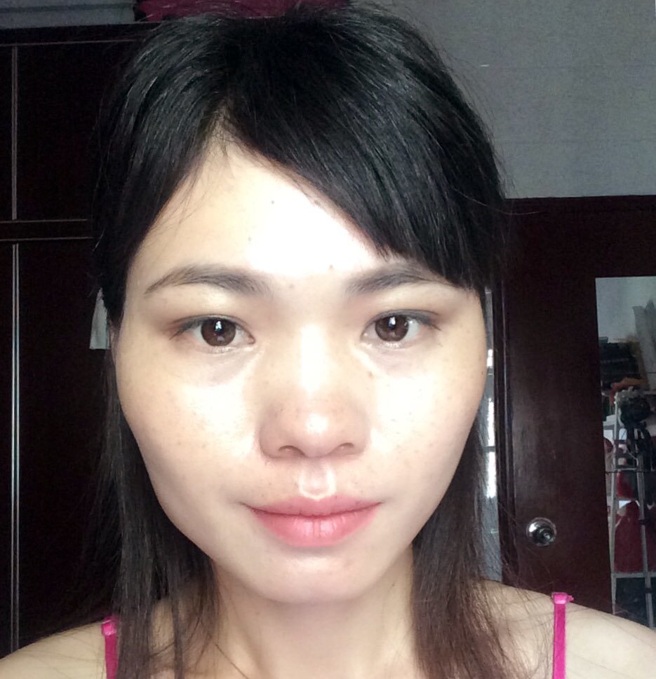 你好,像我这种颧骨大,下颚角大的还有