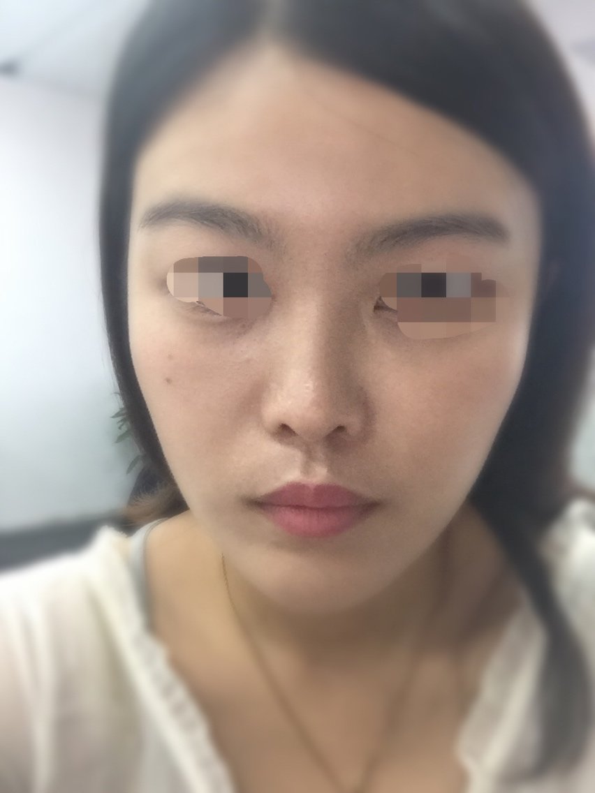 说实话我的正面和侧面就不是同一个人.