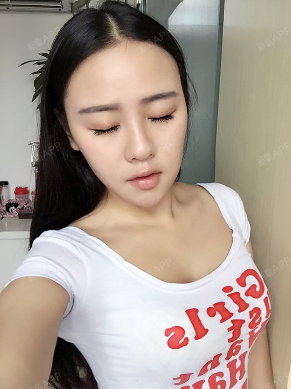 份打得法思丽破尿酸鼻子和下巴可以维持多久,