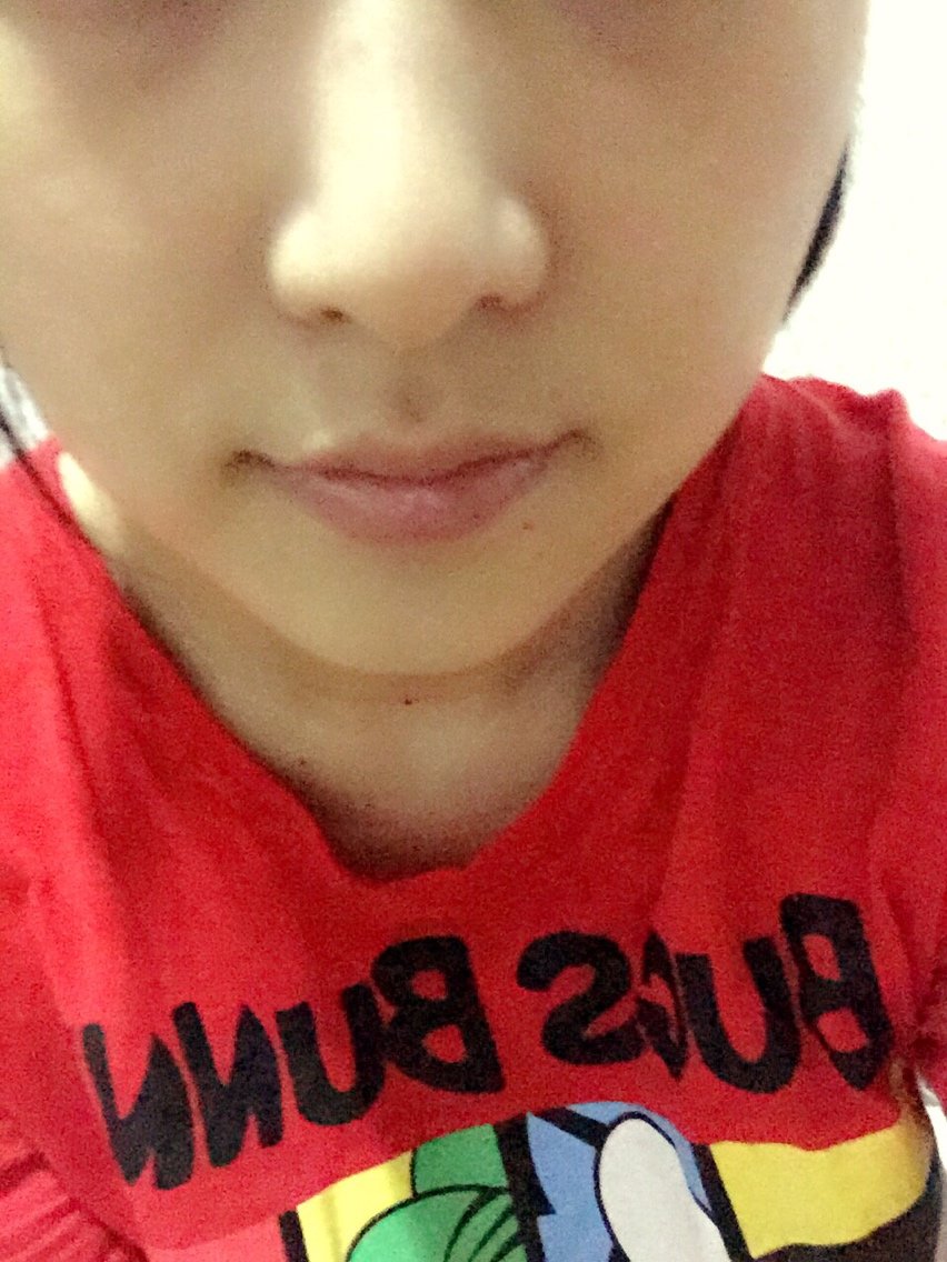 脸确实是瘦了原谅我有一边牙疼脸有点肿