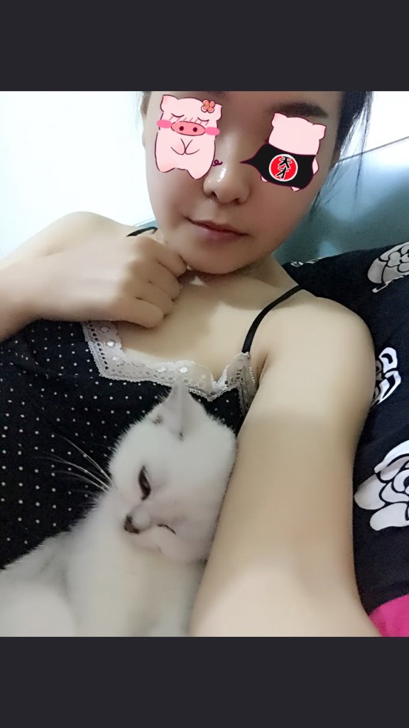 【颧骨下移缩小术第21天】唠神逗比圆午夜郑粉洽谈会开始咯!