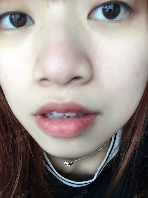 半永久纹唇好不好_效果图_小笨猪半永久纹唇术后第4天