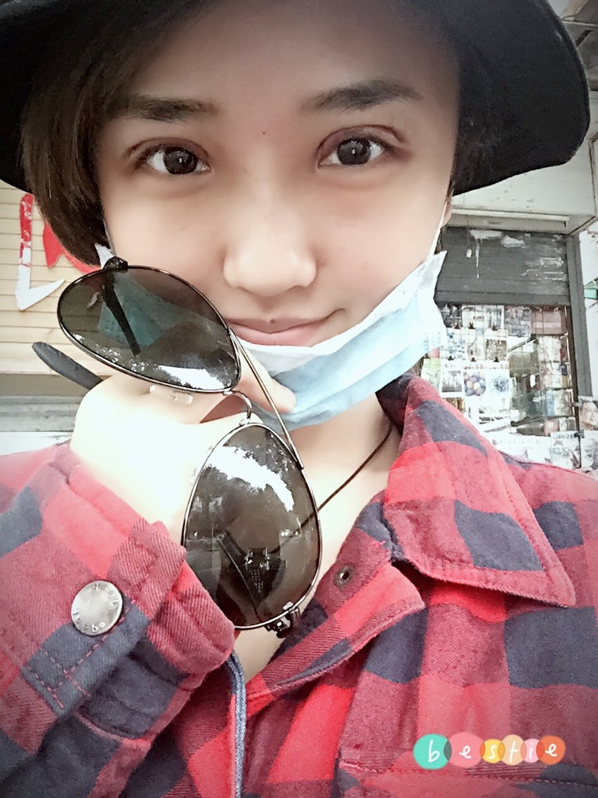 拆掉纱布眼睛向上睁眼稍微有疼痛感.