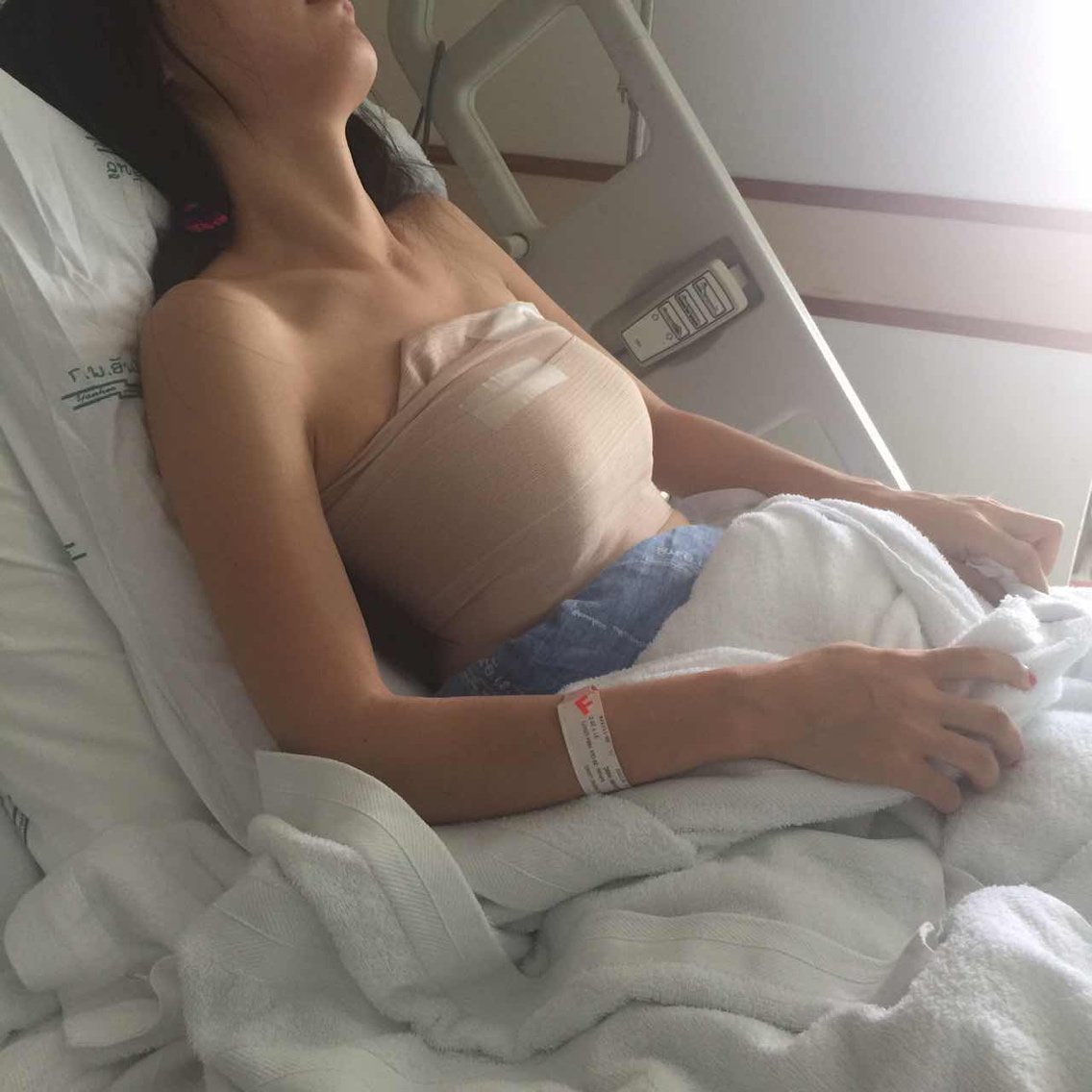 泰国yanhee国际医院假体隆胸怎么样_恢复过程_效果_球