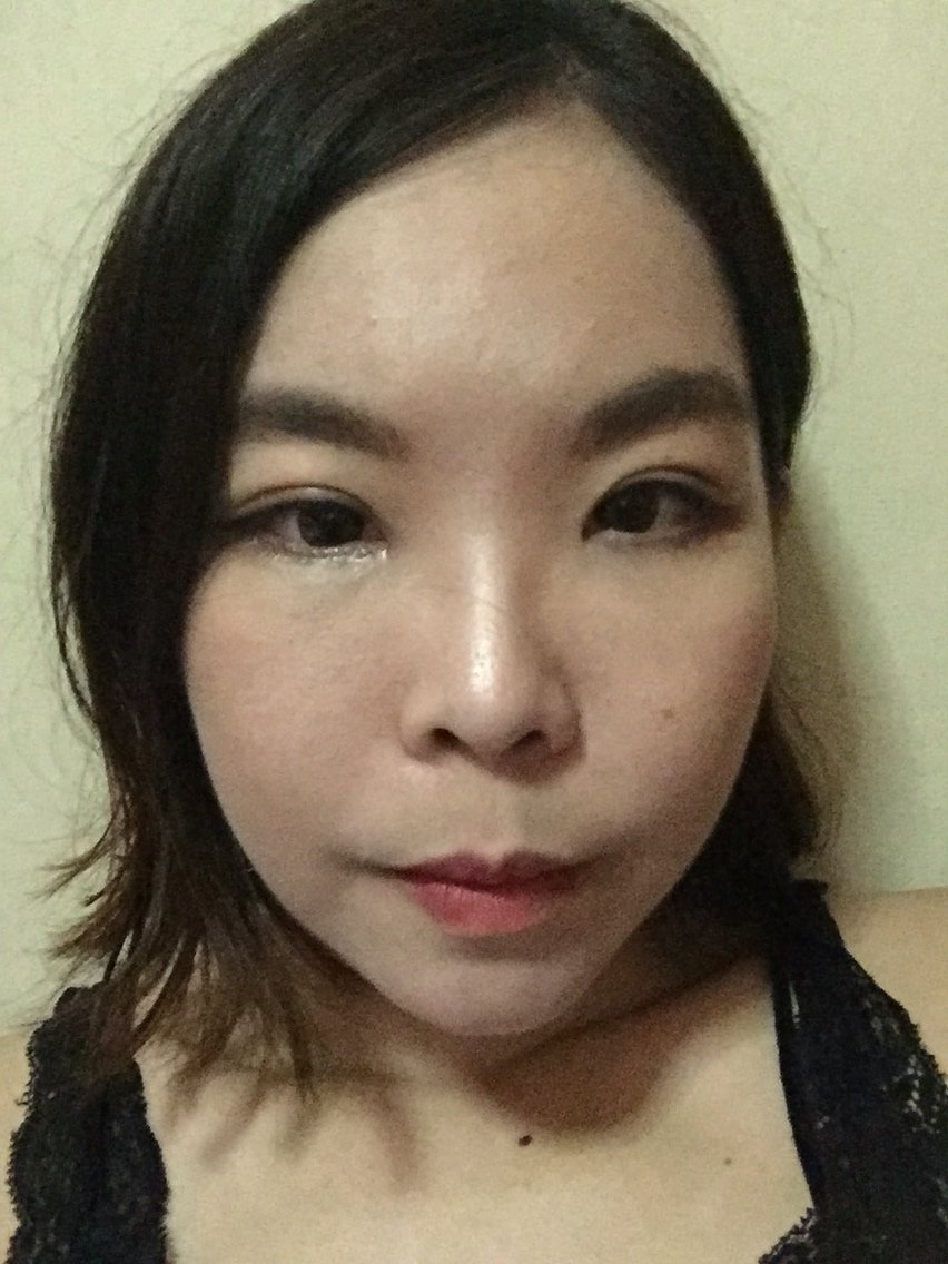 面部轮廓 颧骨颧弓 自体脂肪填充丰苹果肌 v-line瓜子脸手术