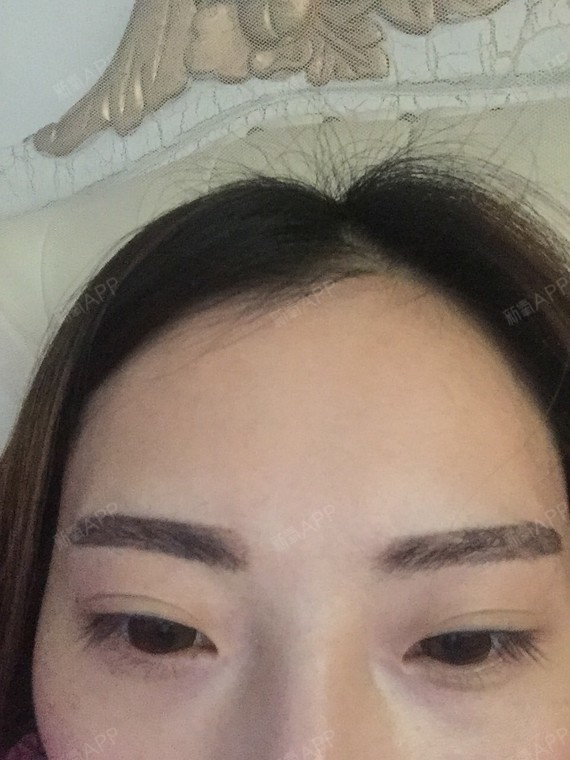 亲爱达们,知道上海哪里激光洗眉好吗