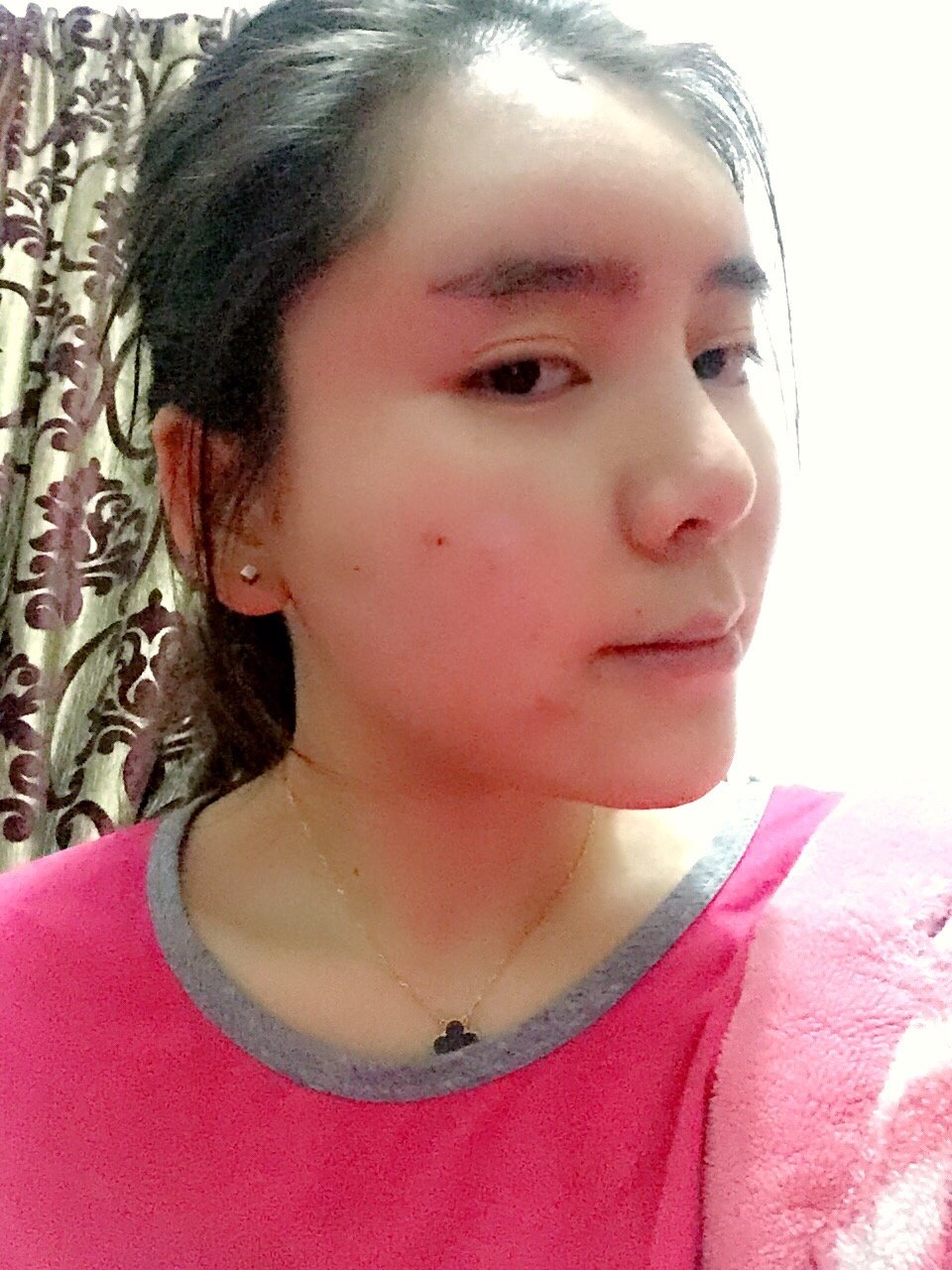 新氧- 女人还是要美美的出门 | 术后当自强 | 新氧 | 自体脂肪移植丰