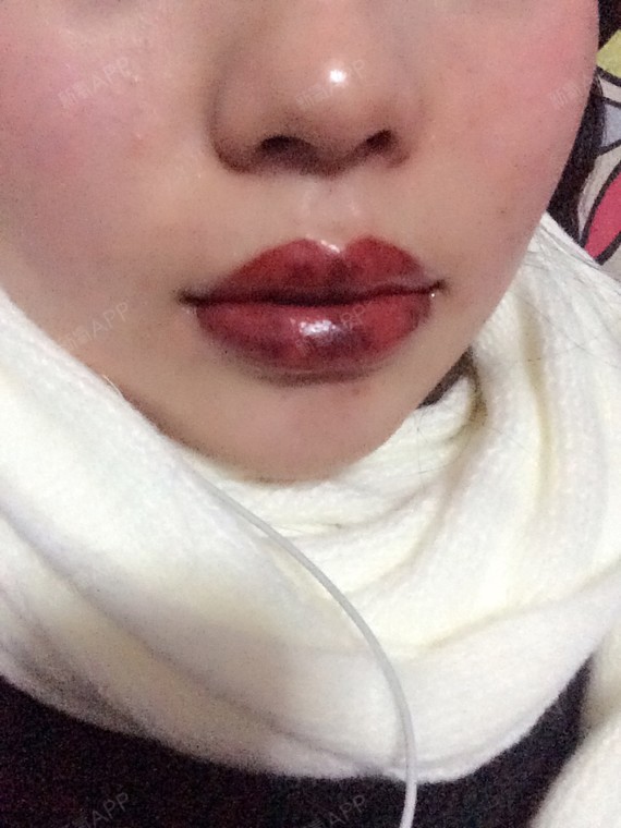 氧气_hepi7ff71半永久纹眉第1天美丽日记