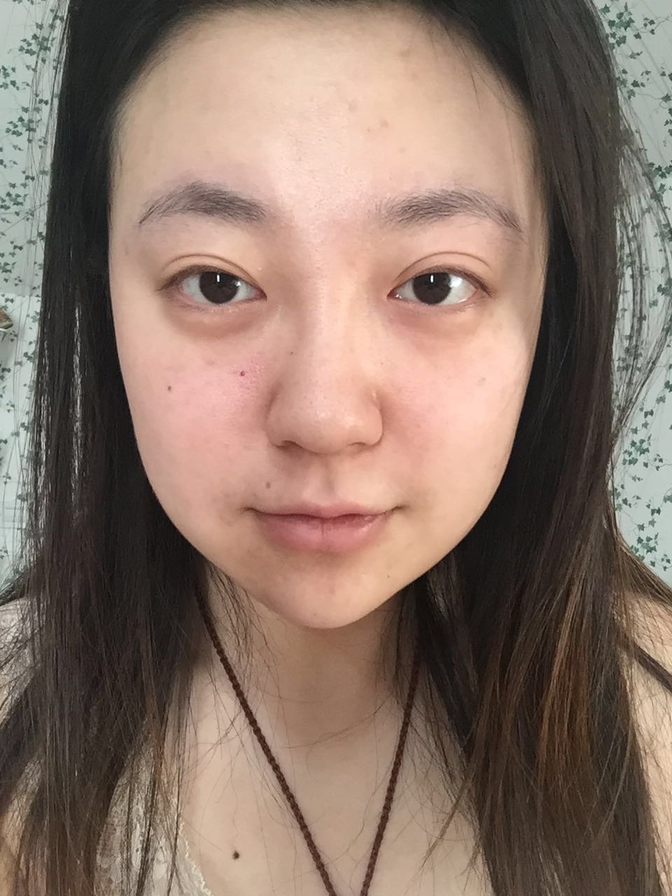 刘大大和新氧姐 请问我的鼻子要怎么做 感觉全脸都太平
