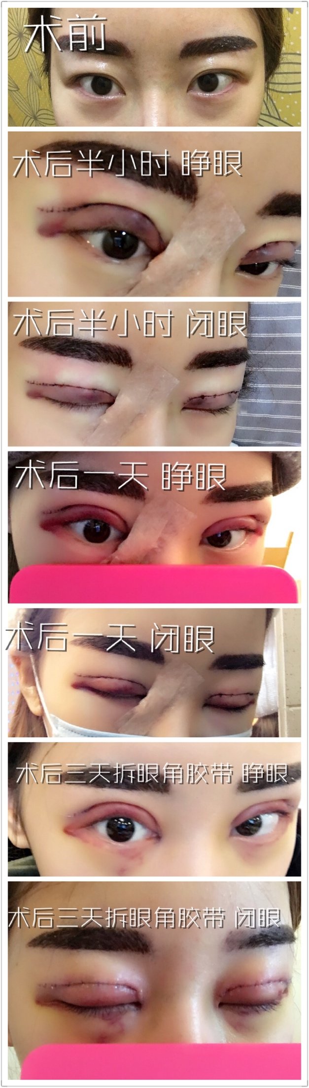 最后一张照片是前几天去韩国陪姐们做鼻子我跟院长的合影.就酱紫!