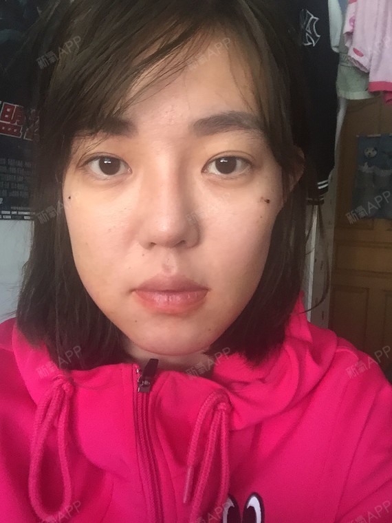 我脸大了很多,右边比左边明显大一圈是怎么回事,没填充好还是