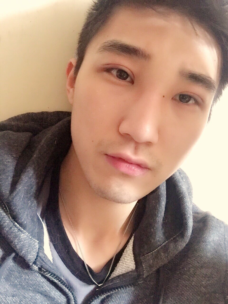 术后当自强 | 新氧 | 全切开双眼皮 | 眼部整形 | 双眼皮 | 男生整形