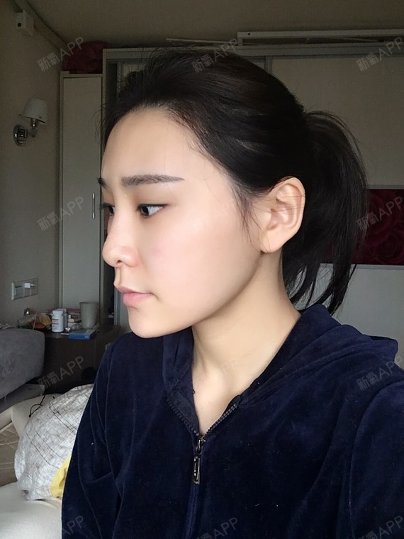 这样的脸型 如何变美 脸型有点长 侧面有点臃肿的感觉 求点建议 谢谢