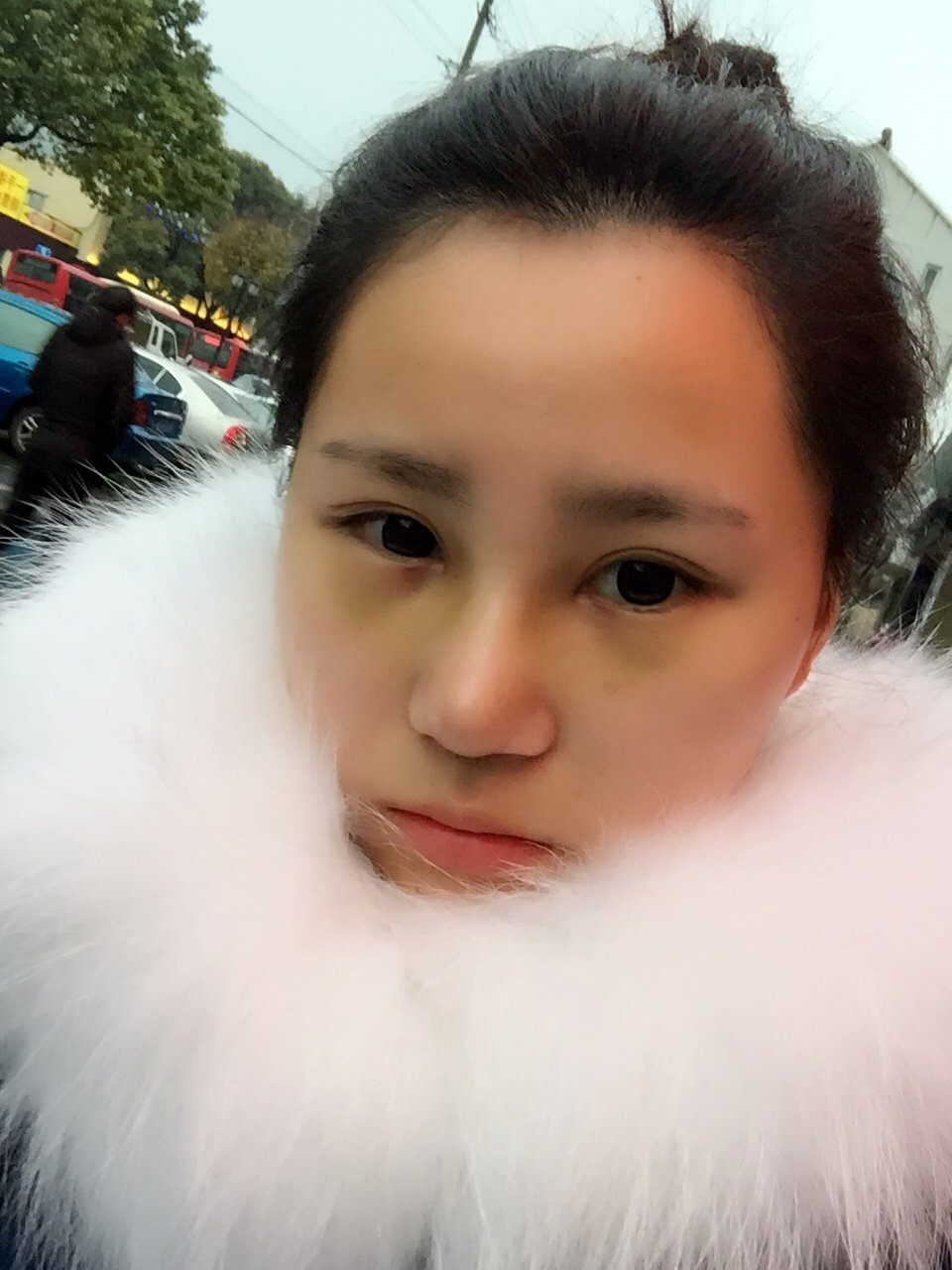 新氧 萌萌酱l 术后当自强 新氧 硅胶隆鼻 鼻部整形 隆鼻
