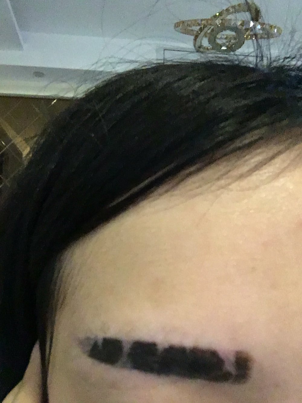 超恶心的掉痂期.