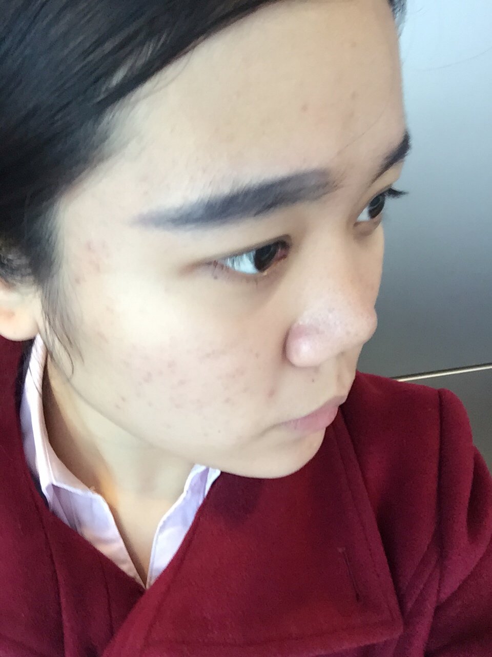 1,标题【上海余天成"打造网红"代言人】 救救我的塌鼻子