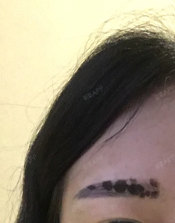 爱美让人受尽委屈半永久纹眉第9天美丽日记-新氧美容