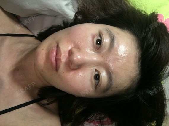 我是方脸,而且咬肌位置靠上,平躺这好像就不是