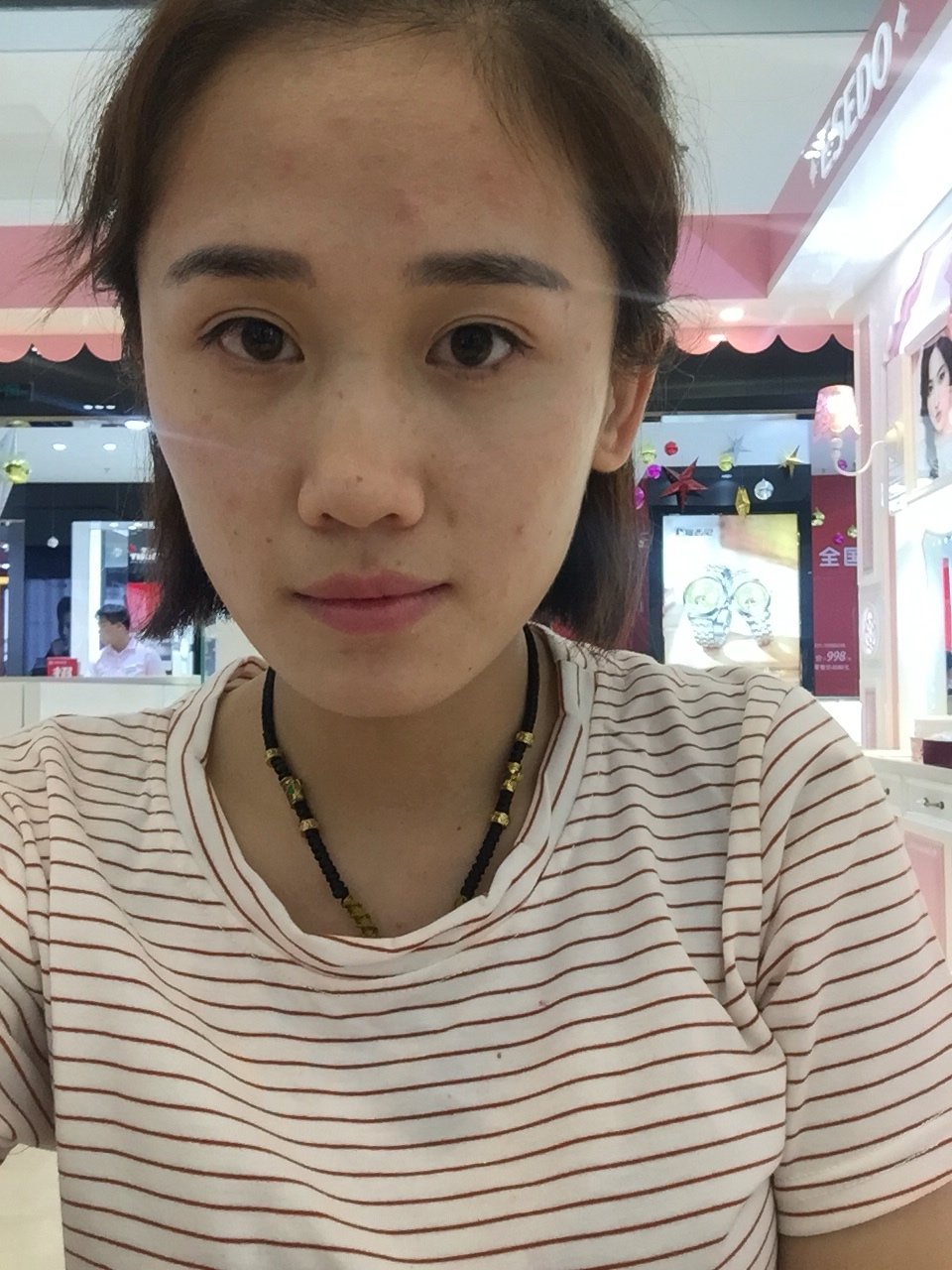 我照相大小脸特别明显.医生