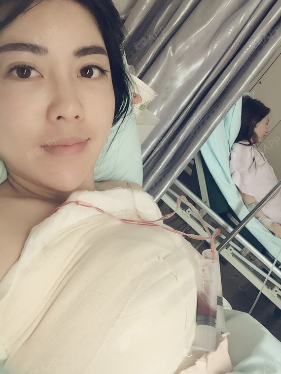 感觉都快躺傻了,起来还有有点头晕晕的,不过还好还不疼,就是绷带包裹