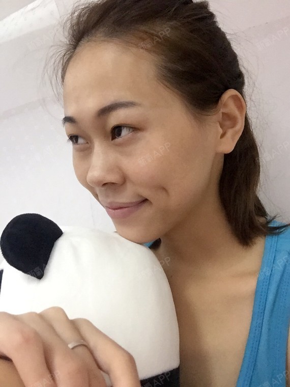 【重庆华美整形美容医院免费招募代言人】 _圈子-新氧