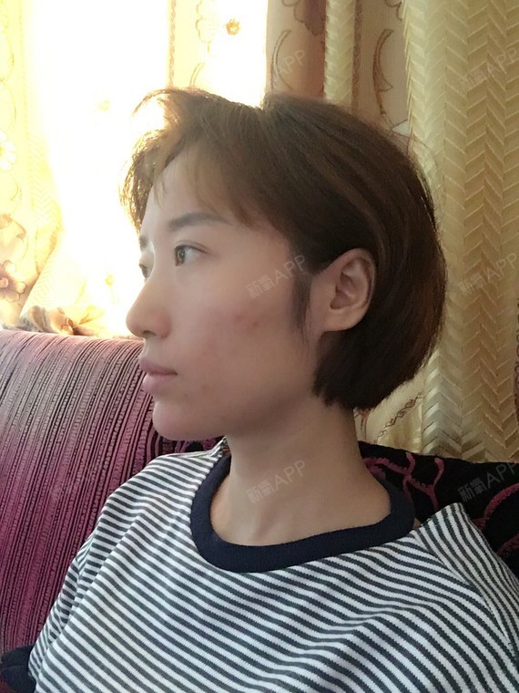 重庆华美整形美容医院免费招募代言人+我想要