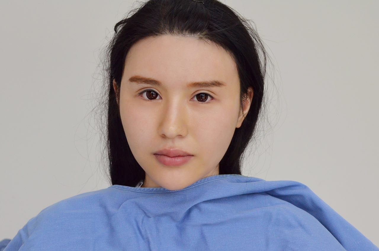 江苏南京施尔美整形美容医院(华东旗舰店)玻尿酸丰肌