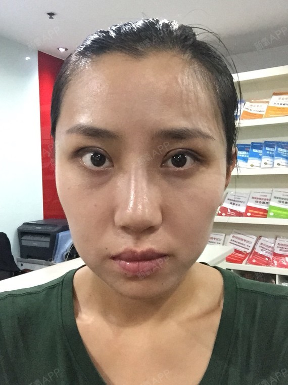还显老!该怎么变温_圈子-新氧